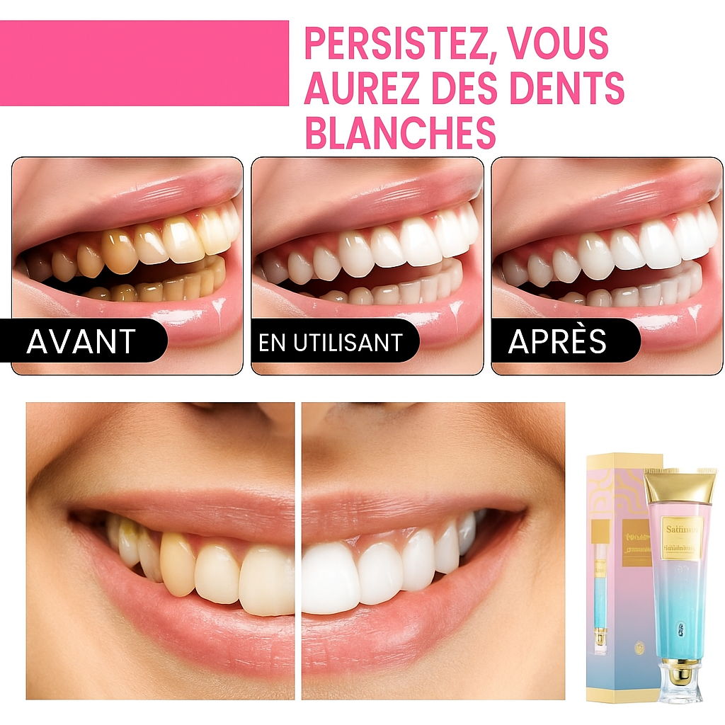 🦷 BodyAccel – Le secret d’un sourire éclatant et sain !